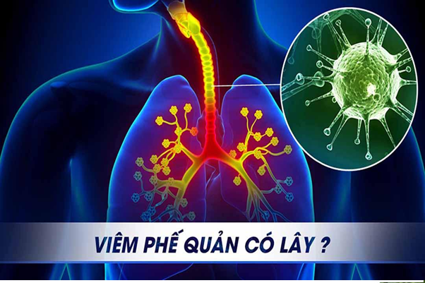 Viêm phế quản có lây không?